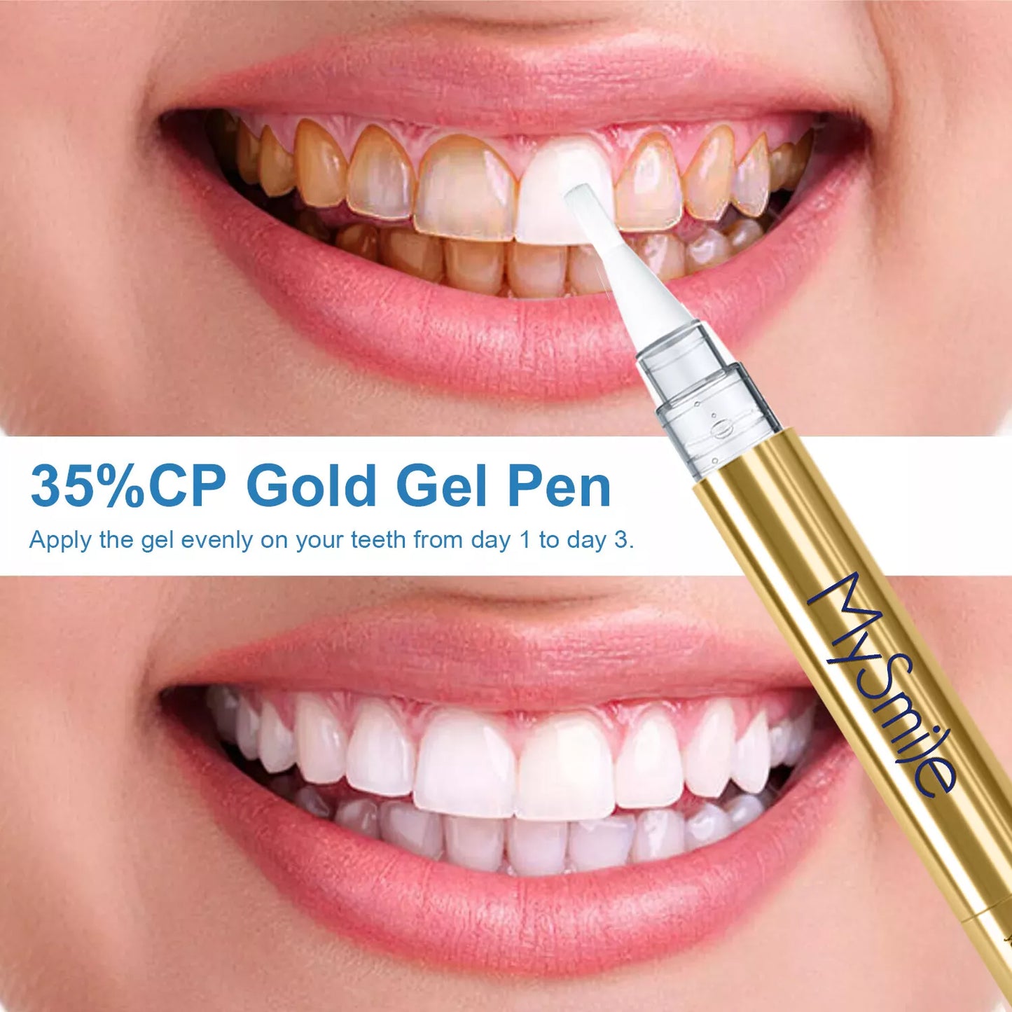 2Packs Deluxe Teeth Whitening Kit with 28-LED Light, 8X Teeth Whitening Pen Whitening Gel Refills, 10Mins Results, Remove 10 Years of Stains
