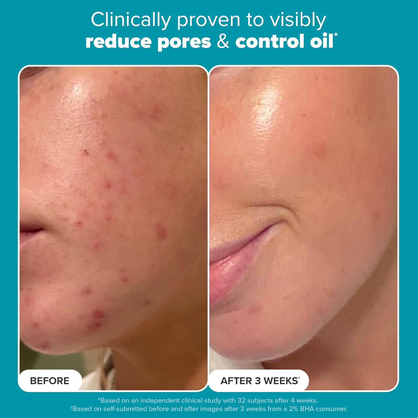 SKIN PERFECTING 2% BHA Liquid Exfoliant Polish, Salicylic Acid Exfoliant-Facial Polish for Enlarged Pores, Wrinkles & Fine Lines, Suitable for Blackhead-Prone Skin, Fragrance-Free