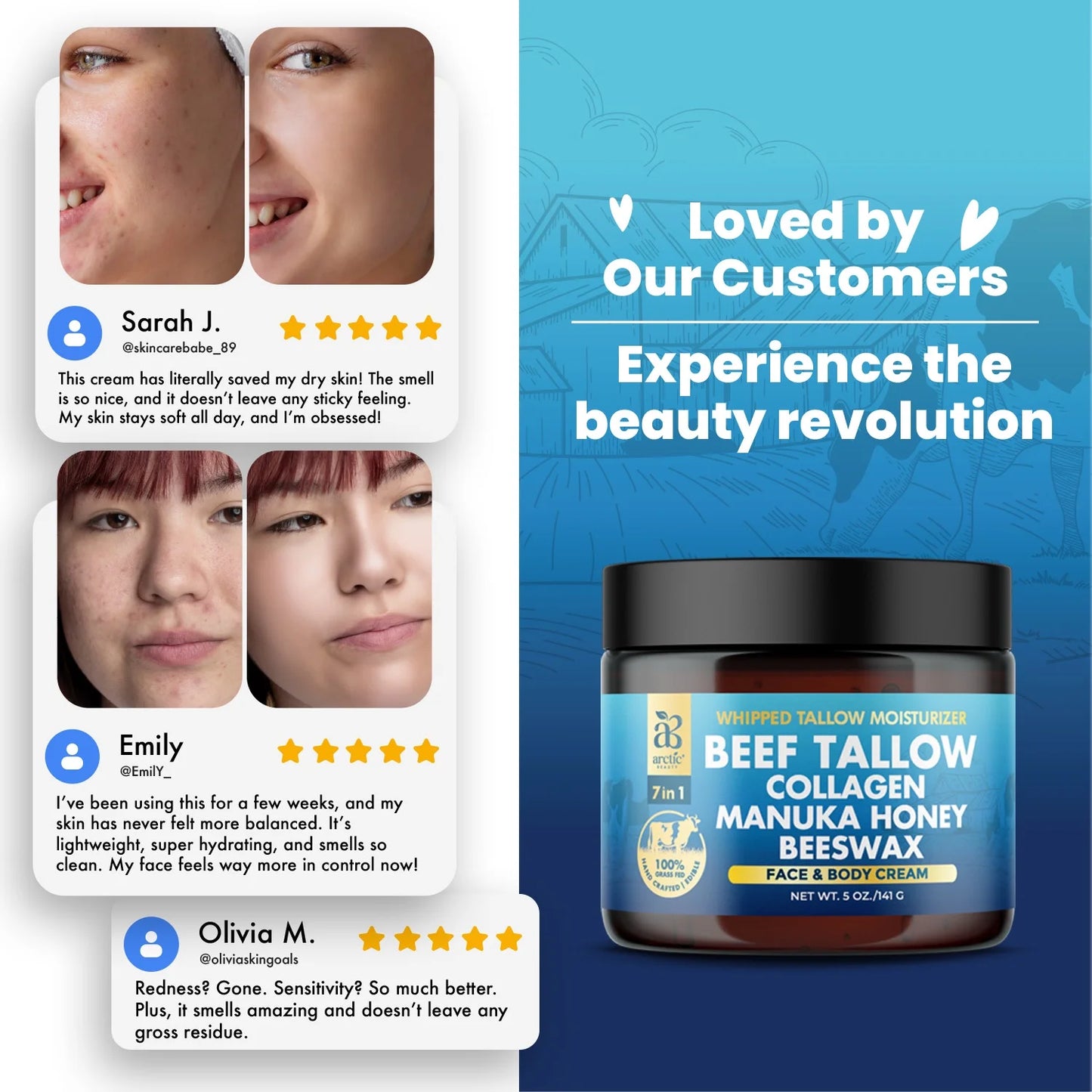 Beef Tallow, Organic Grass-Fed Beef Tallow Balm with Manuka Honey, Aloe Vera, Jojoba Oil, Olive Oil, Beeswax & Collagen, Natural Moisturizer for Face, Body & Lips, Hydrates Dry, Cracked Skin, 5Oz