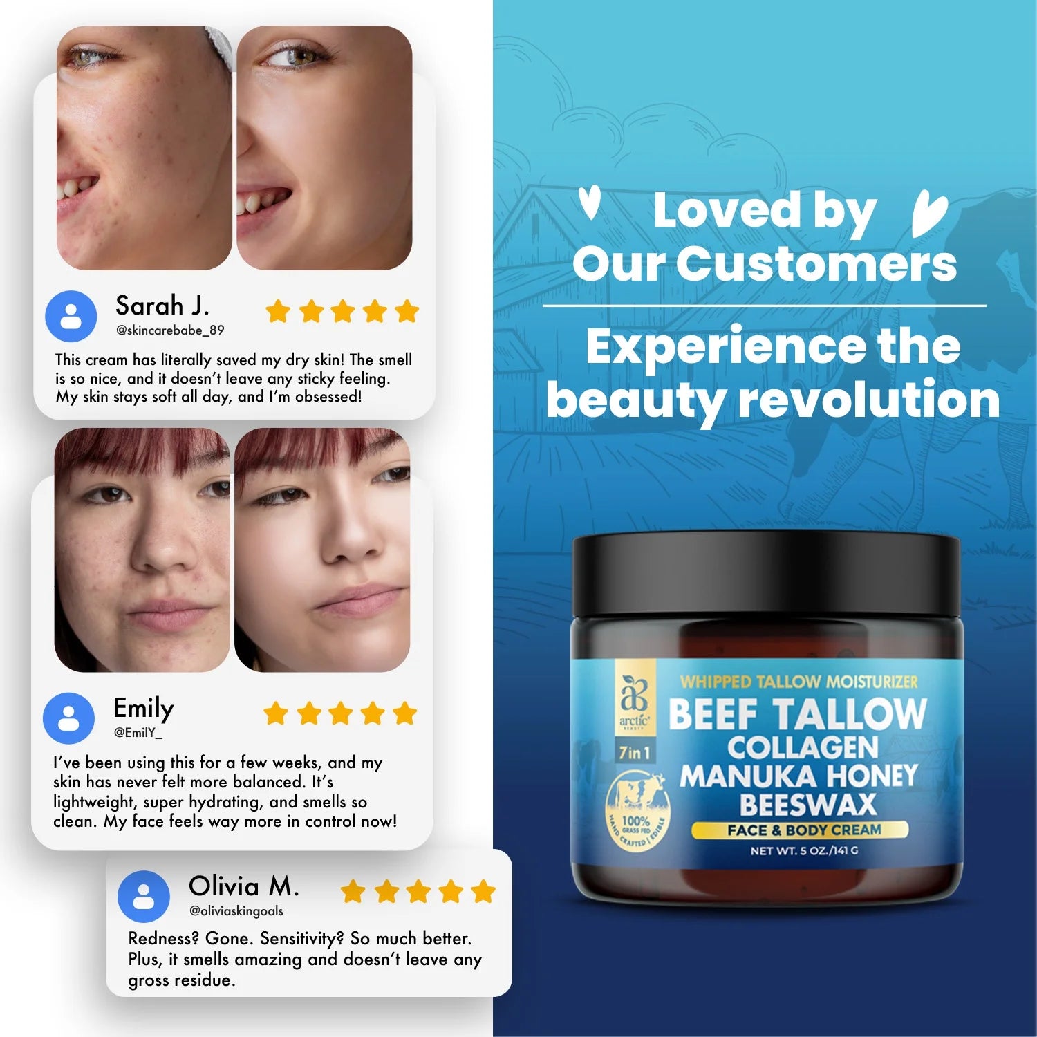 Beef Tallow, Organic Grass-Fed Beef Tallow Balm with Manuka Honey, Aloe Vera, Jojoba Oil, Olive Oil, Beeswax & Collagen, Natural Moisturizer for Face, Body & Lips, Hydrates Dry, Cracked Skin, 5Oz