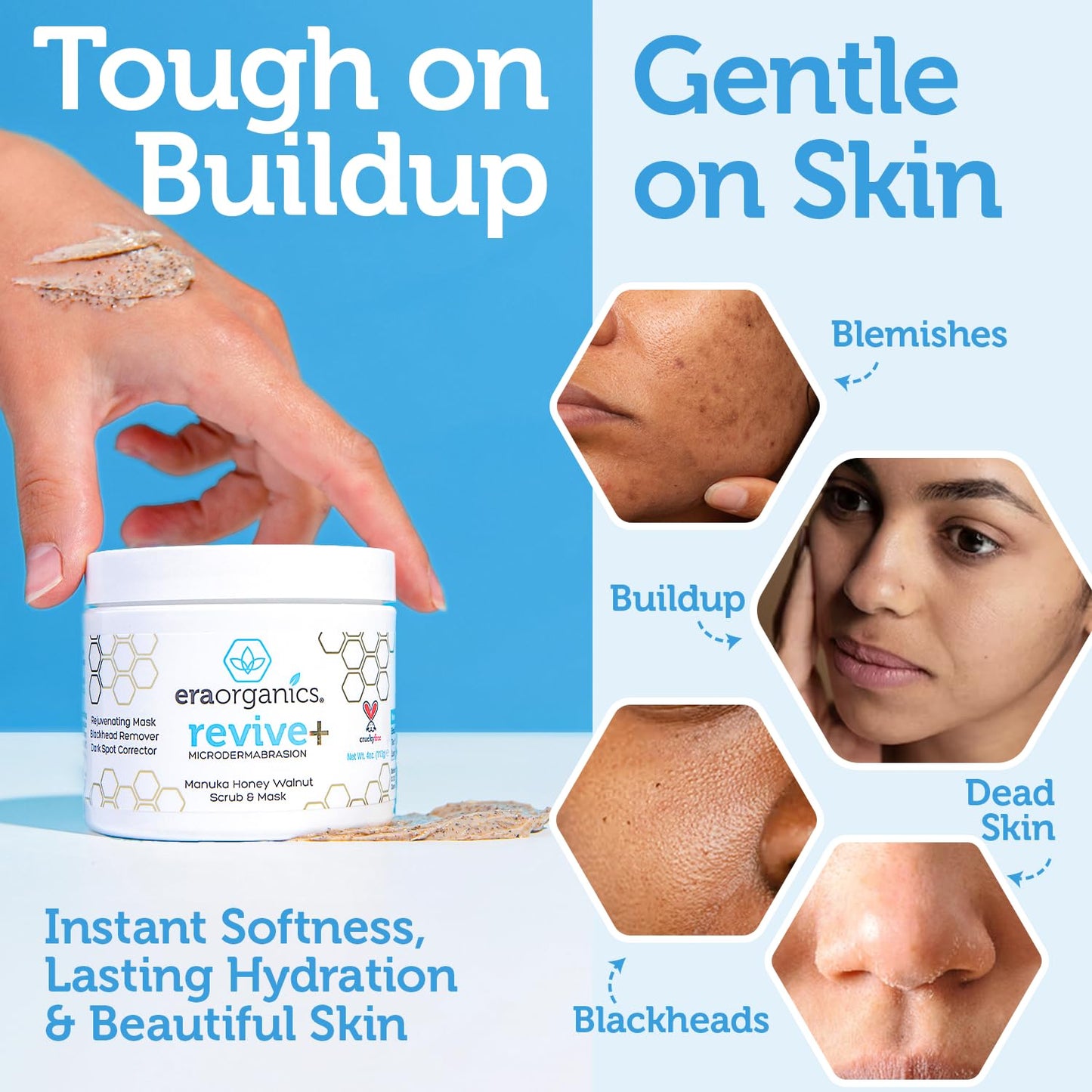Microdermabrasion Facial Scrub & Face Exfoliator - Spa Quality Exfoliating Mask with Manuka Honey plus Walnut for Blackheads, Buildup, Wrinkles 2Oz
