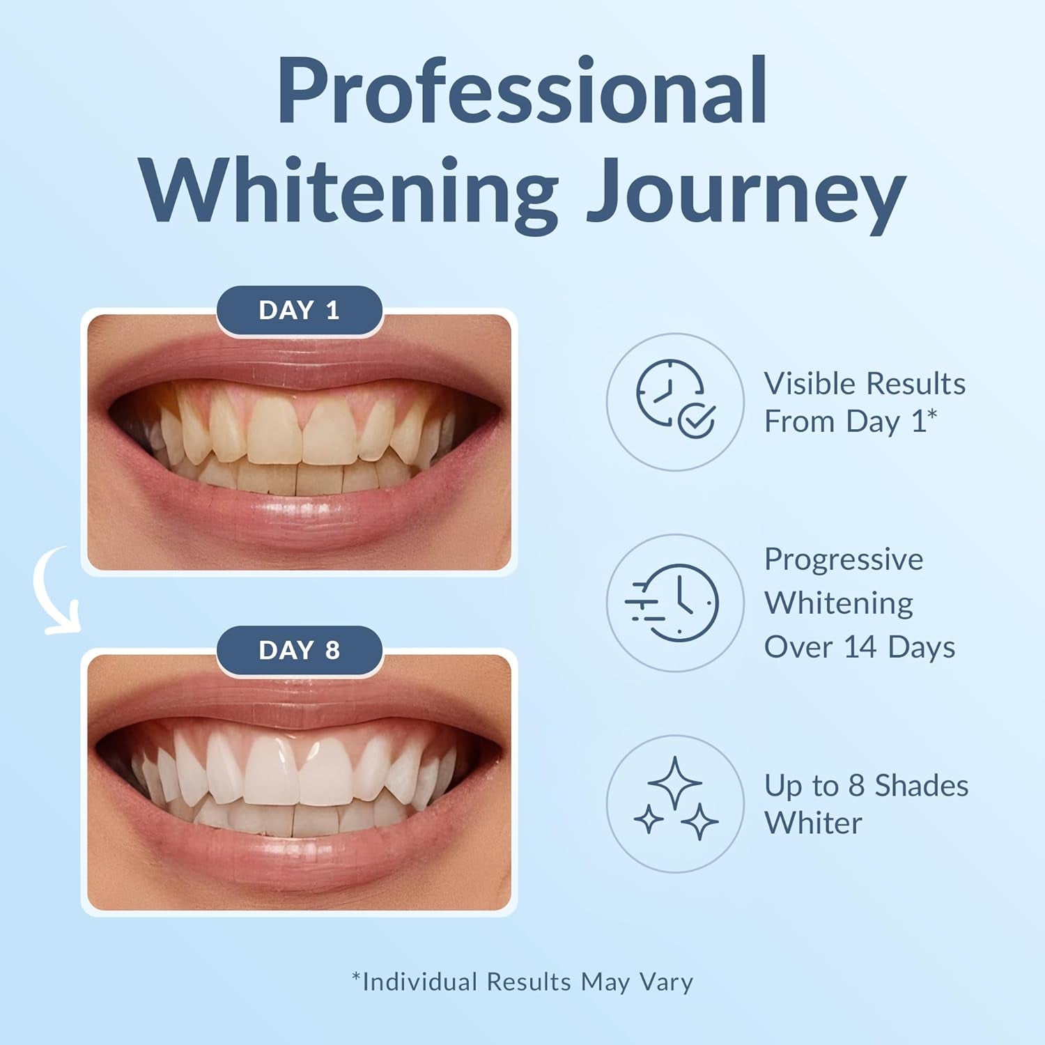 DRDENT Professional Teeth Whitening Strips - Pack of 44 Strip - 22 Treatments Kit - Safe for Enamel - Non Sensitive Teeth Whitening - Whitening without Any Harm + Mouth Opener Included