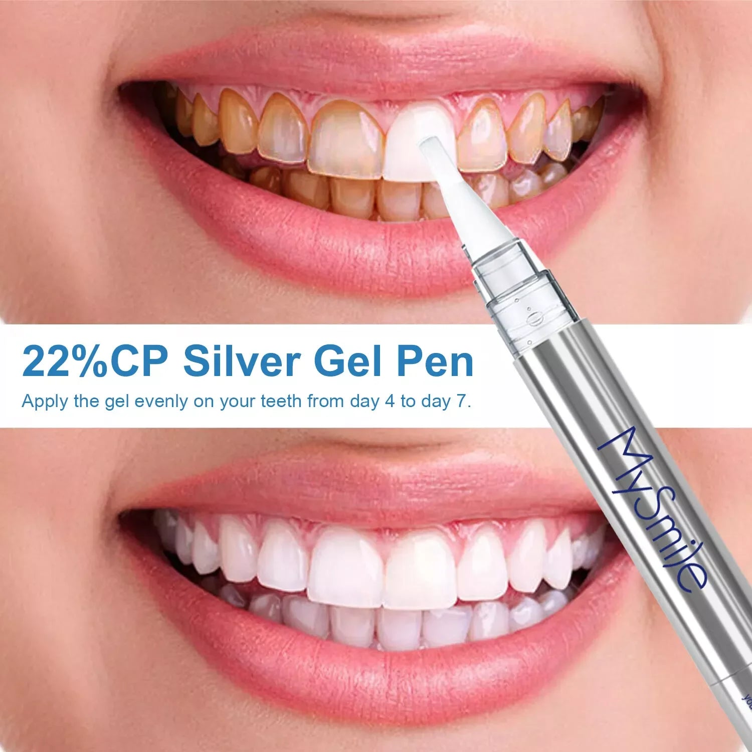2Packs Deluxe Teeth Whitening Kit with 28-LED Light, 8X Teeth Whitening Pen Whitening Gel Refills, 10Mins Results, Remove 10 Years of Stains